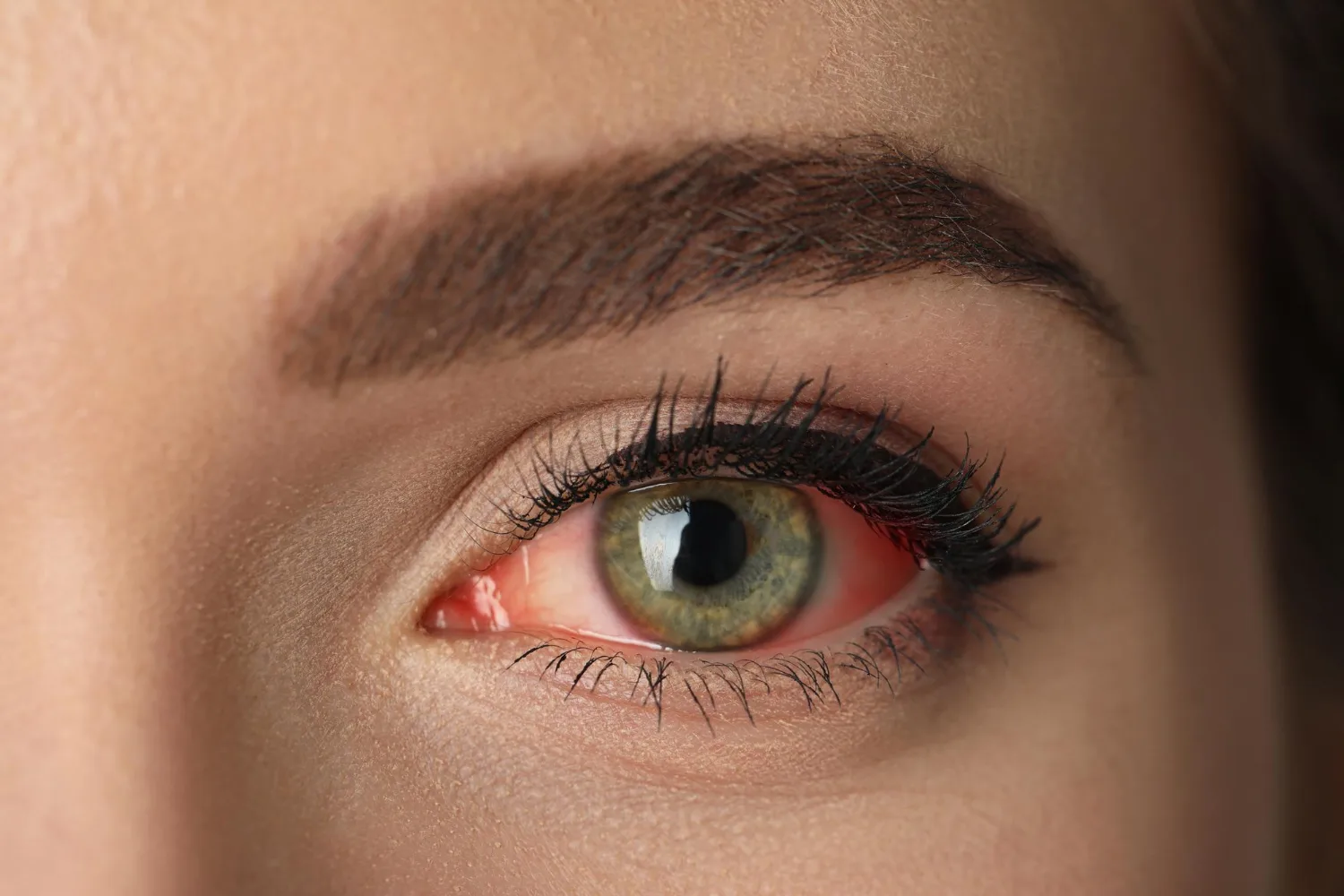 Clínica de ojo seco en CDMX: Atención Especializada para tu Salud Visual